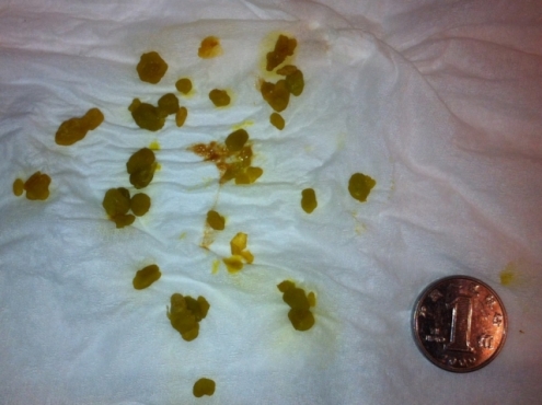 M{CIDR}9BE5HINDC1HOR7.jpg